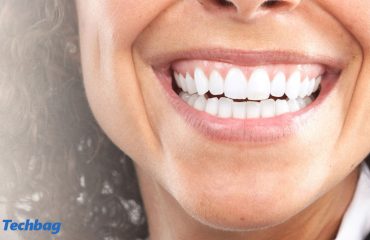 سفید کردن بیش از حد دندان